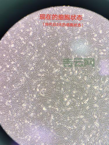 Loadimage加载图片不显示？这几个原因要排查！